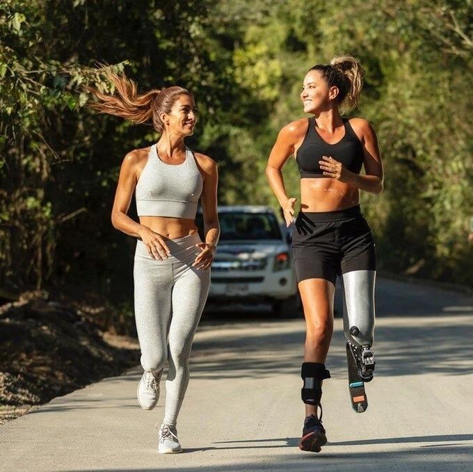 Câu chuyện truyền cảm hứng của hoa hậu xinh đẹp bị cưa một bên chân-4