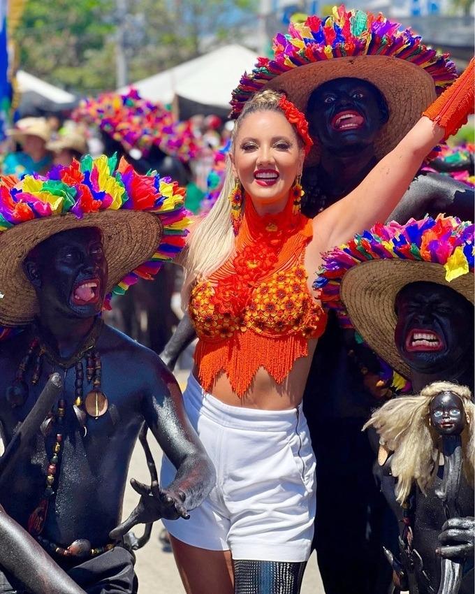 Câu chuyện truyền cảm hứng của hoa hậu xinh đẹp bị cưa một bên chân-12