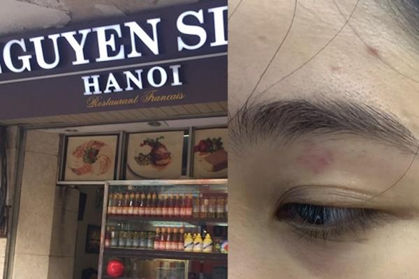 Nhảy rào ở độ cao 240m để sống ảo, chàng trai Mỹ suýt mất mạng-3