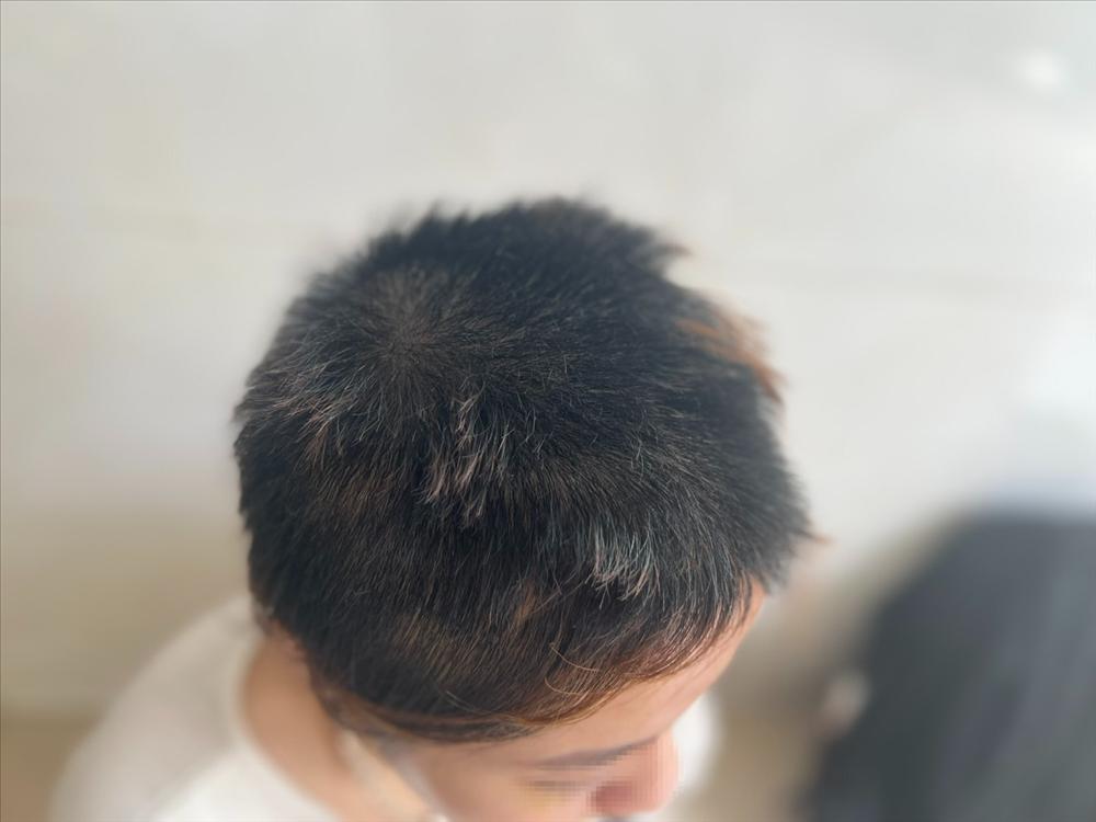 Vụ thiếu nữ 16 tuổi bị chủ spa hành hạ vì ghen tuông: Không dám ra đường!-2