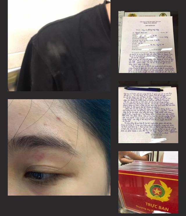 Nhân viên quán bánh mỳ Nguyên Sinh đánh khách ảnh hưởng nghiêm trọng đến hình ảnh Thủ đô trong mắt du khách quốc tế-1