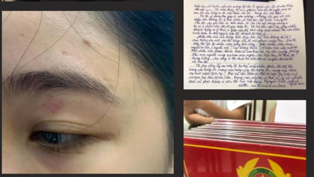 Vụ 2 nhân viên quán bánh mì đánh khách: Hướng dẫn bị hại đi giám định-1