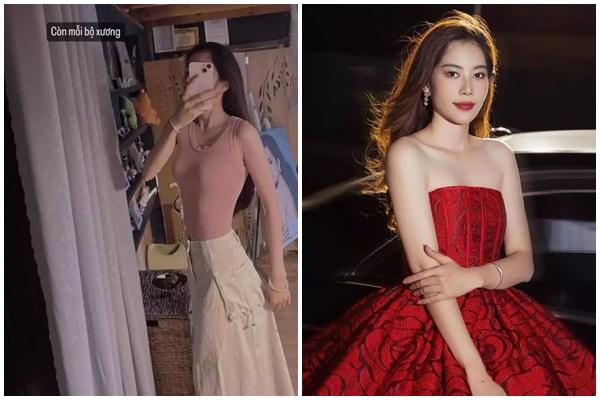 Nam Em gây lo lắng khi để lộ cánh tay đỏ bầm kèm chia sẻ đầy tâm trạng-6