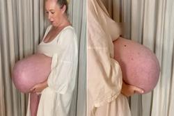 Chiếc bụng bầu kỳ quặc khiến thai phụ 'sốt xình xịch' trên mạng xã hội