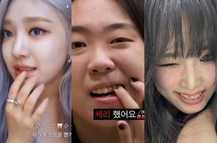 Trend răng đính đá được Lisa và loạt idol mê mẩn dạo này bỗng gây tranh cãi-3