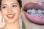 Trend 'răng đính đá' được Lisa và loạt idol mê mẩn dạo này bỗng gây tranh cãi