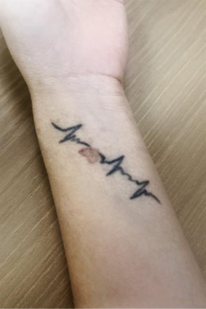 Tình yêu tan vỡ, cô gái cầu cứu bác sĩ xóa hình xăm nhạy cảm-1