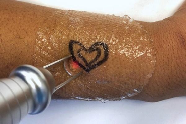 Đêm tân hôn tôi đau đớn phát hiện hình xăm khó chấp nhận trên lưng chồng-2