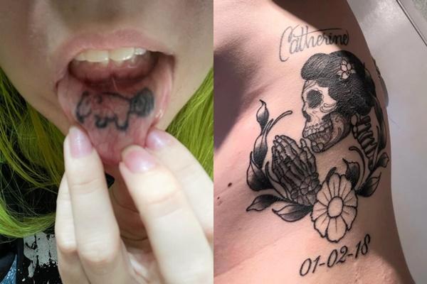 Người đàn ông chi 200 triệu để thực hiện nhiều ca phẫu thuật kinh dị trong 8 năm-4