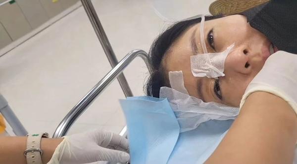 Nữ ca sĩ bị thương giác mạc, nhập viện khẩn cấp sau sự cố bất ngờ lúc quay phim-1