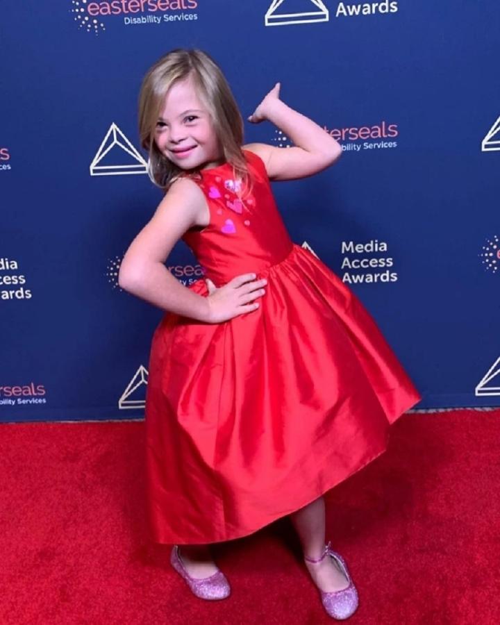 Cô bé mắc hội chứng Down bị bỏ rơi và hành trình trở thành ngôi sao Hollywood-1