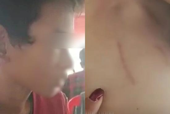 Xác minh vụ thiếu niên 14 tuổi bị cha dượng hành hạ, đốt ‘vùng kín’