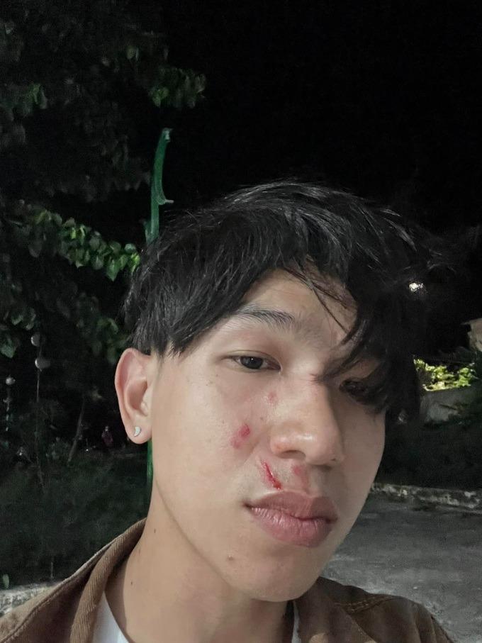 Hướng dẫn viên đảo Phú Quý đánh nhau với du khách-1