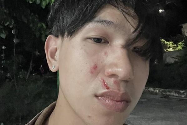 Điều tra vụ nhóm thanh niên hành hung cô gái trong quán ăn-3