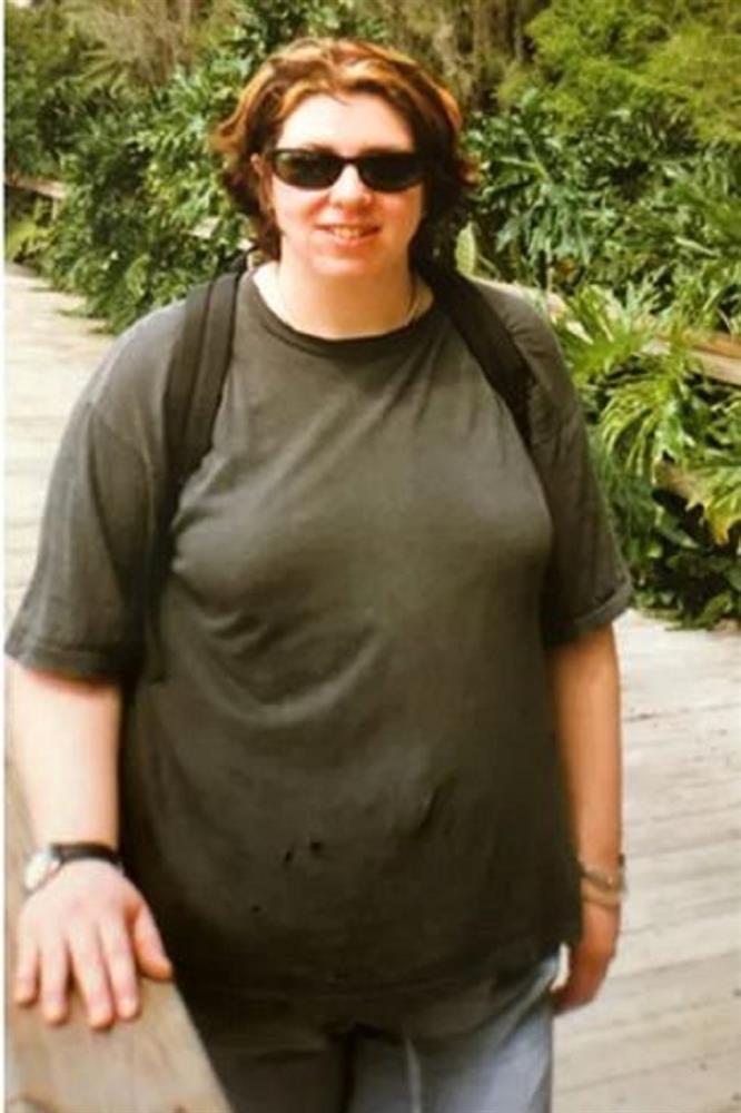 Cắt bỏ 2kg da bụng thừa, nữ nghệ sỹ đem thuộc để biến thành kỷ vật-2