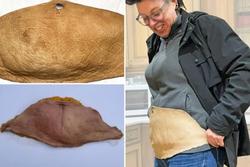 Cắt bỏ 2kg da bụng thừa, nữ nghệ sỹ đem thuộc để biến thành kỷ vật