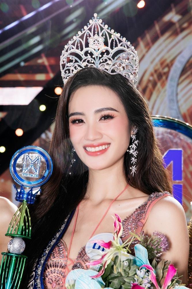Tân Hoa hậu Ý Nhi: Từng bị trêu chiều cao khủng, lột xác sau niềng răng-1