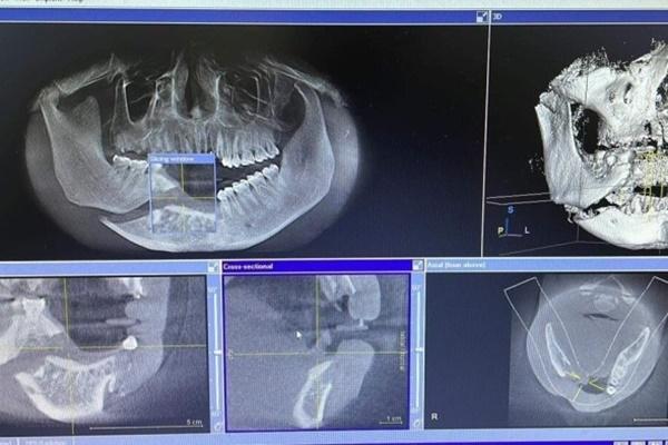 Giải cứu bé gái 11 tuổi mắc kẹt trong thang máy chung cư ở Hà Nội-3