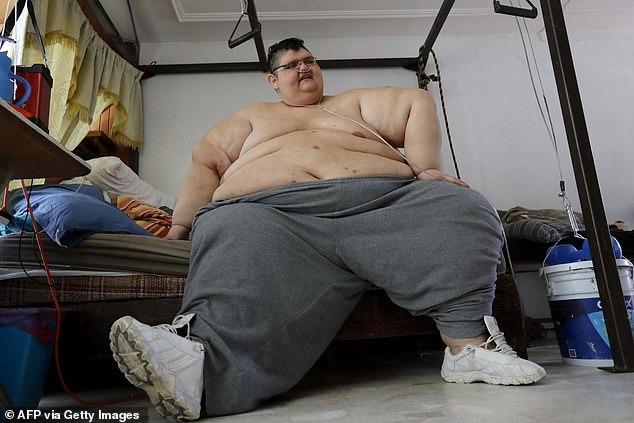Chàng trai béo nhất thế giới từng nặng 575kg bây giờ ra sao sau phẫu thuật giảm cân?-1