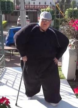 Chàng trai béo nhất thế giới từng nặng 575kg bây giờ ra sao sau phẫu thuật giảm cân?-5