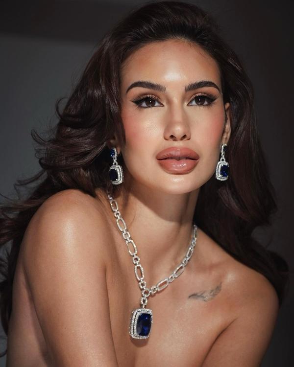 Hoa hậu Hoàn vũ Philippines bị chê gương mặt như thẩm mỹ hỏng-1