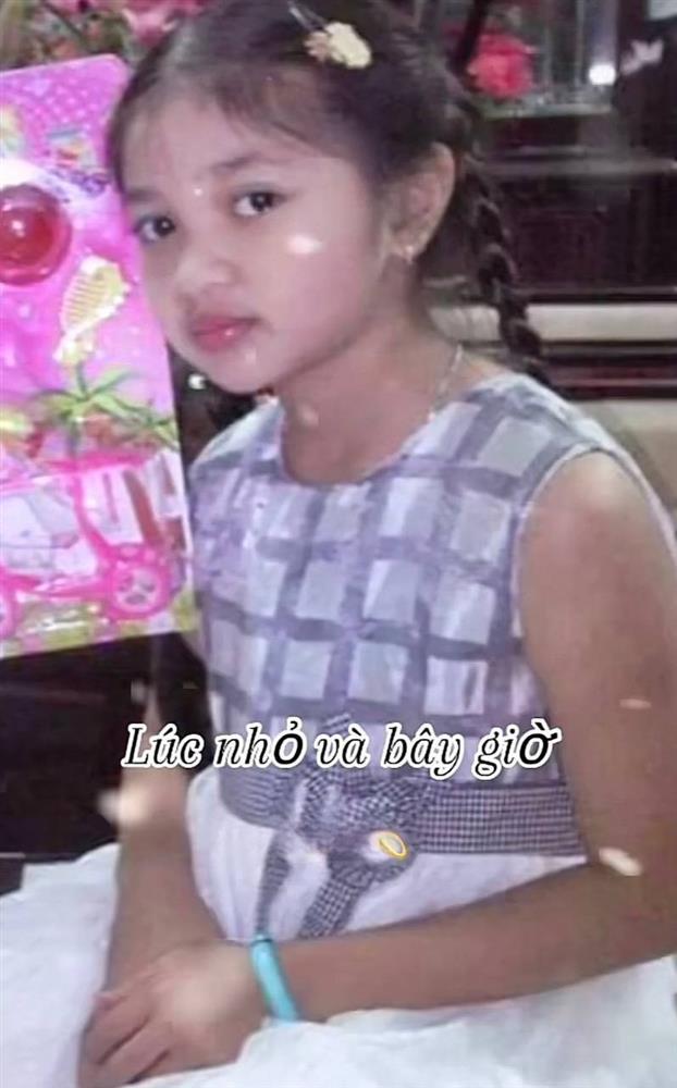 Ảnh lúc nhỏ giúp Á hậu Minh Kiên thoát nghi vấn thẩm mỹ 1 điểm trên mặt-5