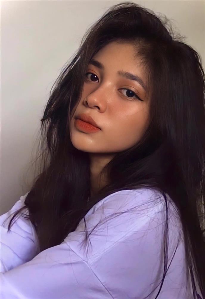 Ảnh lúc nhỏ giúp Á hậu Minh Kiên thoát nghi vấn thẩm mỹ 1 điểm trên mặt-7