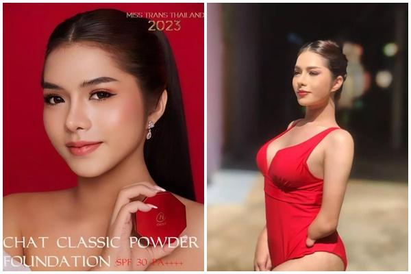 Quá khứ khó khăn của người đẹp cụt 2 chân, 1 tay mới thi hoa hậu-12