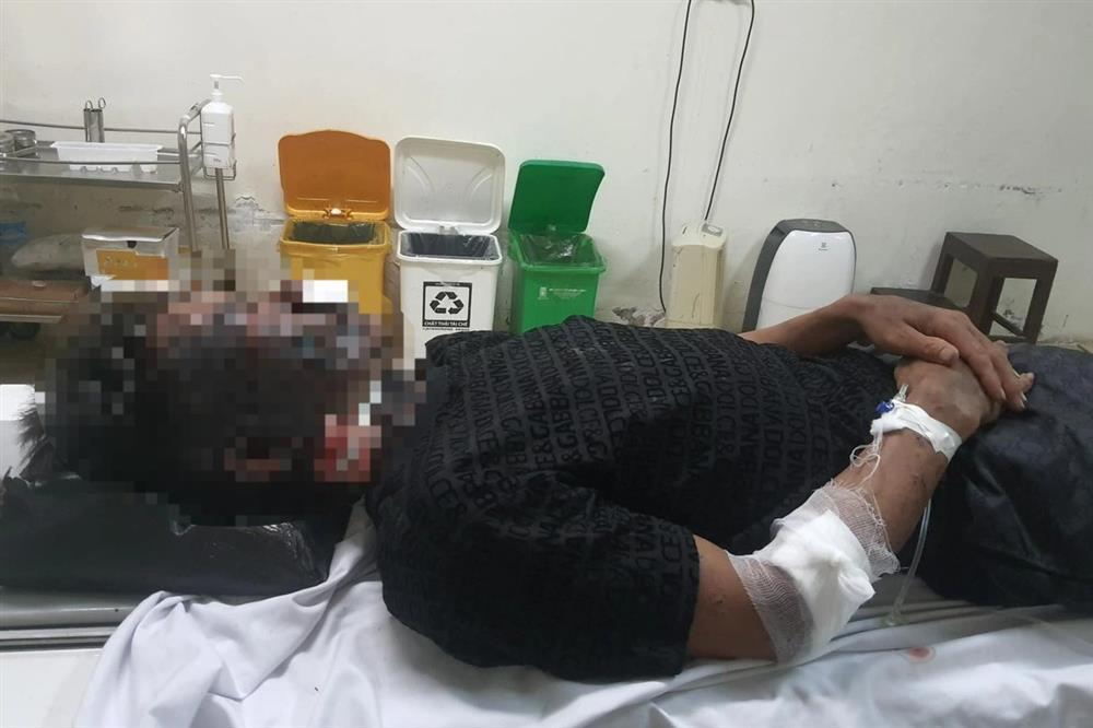 2 thanh niên bị sét đánh trúng khi đi kích cá đêm-1