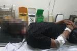 Hai vợ chồng ở Quảng Bình bị sét đánh gây thương vong-2