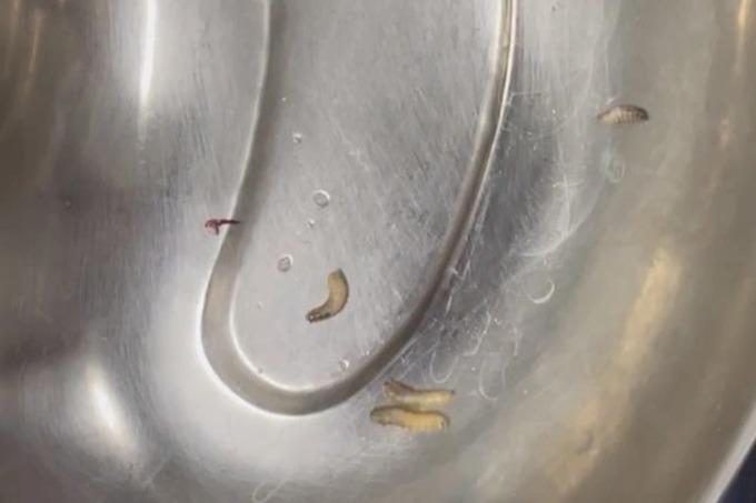 Hàng chục con giòi lúc nhúc trong tai người đàn ông vì nguyên nhân này-1