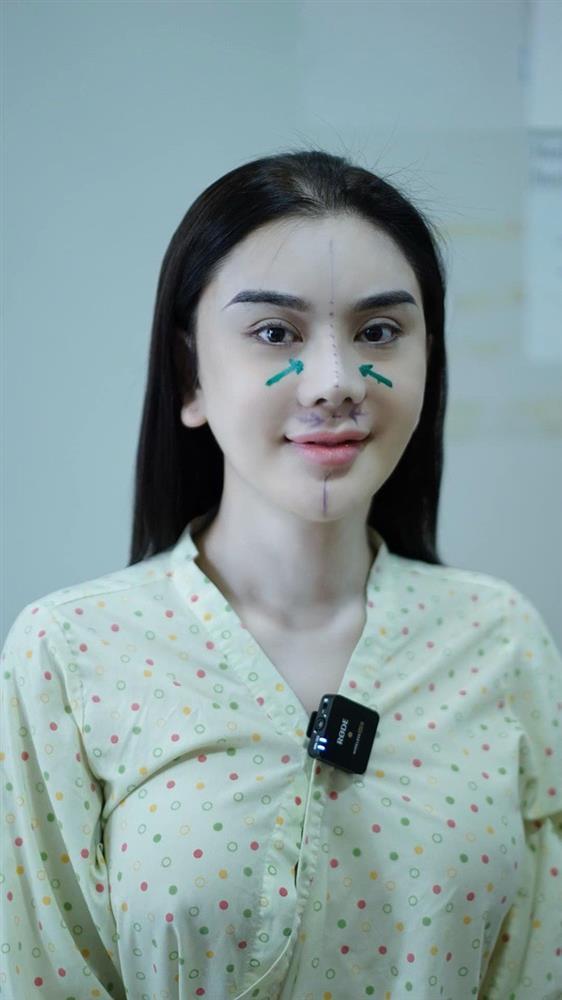 Lâm Khánh Chi bị nghiện thẩm mỹ?-1