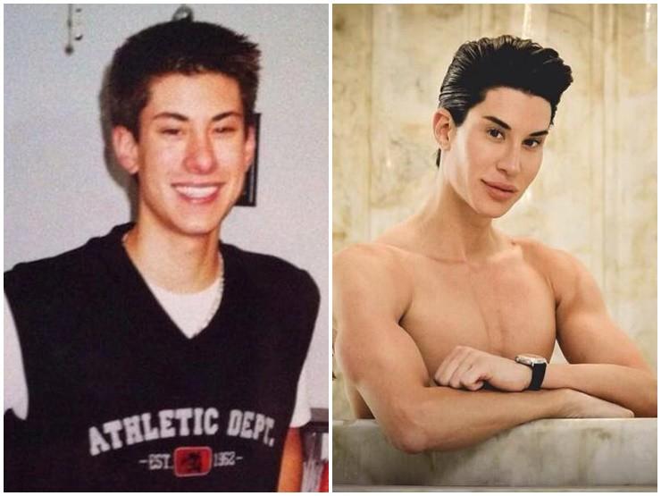 Người đàn ông thực hiện hơn 500 lần phẫu thuật thành búp bê sống giờ ra sao?-1