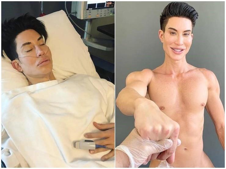 Người đàn ông thực hiện hơn 500 lần phẫu thuật thành búp bê sống giờ ra sao?-2