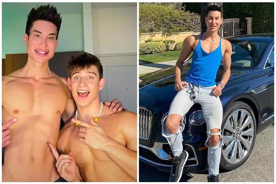 Người đàn ông thực hiện hơn 500 lần phẫu thuật thành 'búp bê sống' giờ ra sao?