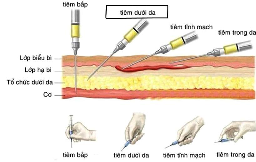 Bác sĩ da liễu lý giải vì sao tiêm meso gây sốt trong thẩm mỹ nội khoa-1