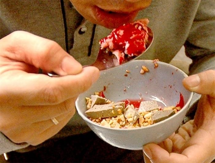 Người đàn ông suy đa tạng sau khi ăn món nhiều người yêu thích-1