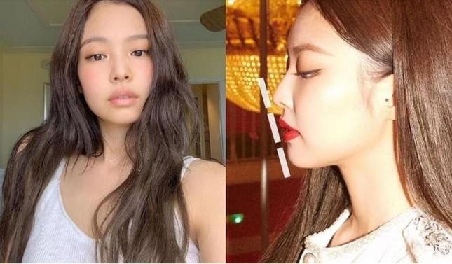 Bác sĩ khẳng định BlackPink phẫu thuật thẩm mỹ nhiều-2