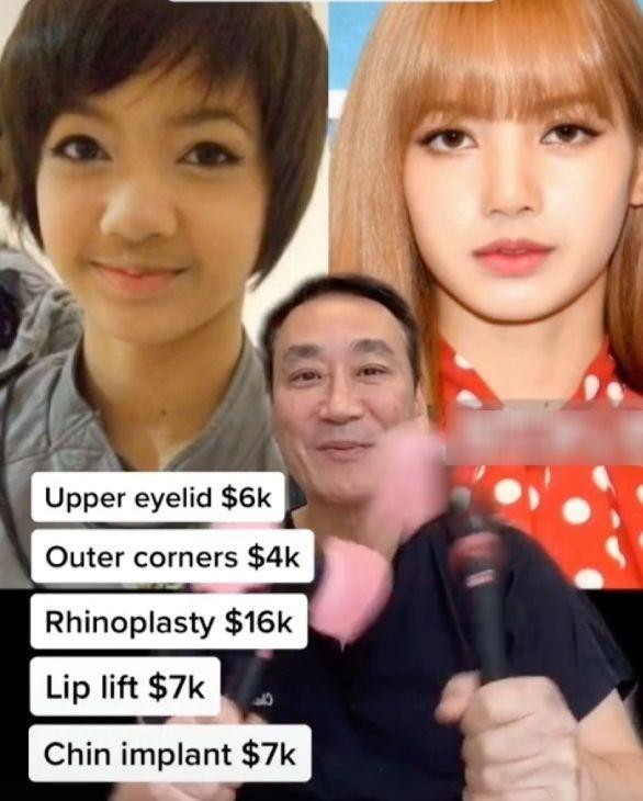 Bác sĩ khẳng định BlackPink phẫu thuật thẩm mỹ nhiều-4