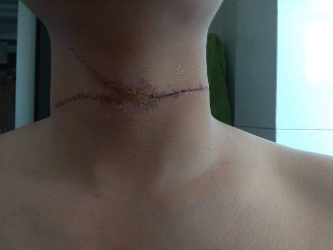 Hà Nội: Dây diều sắc như dao cứa ngang cổ người, chém đứt đầu xe ô tô-2