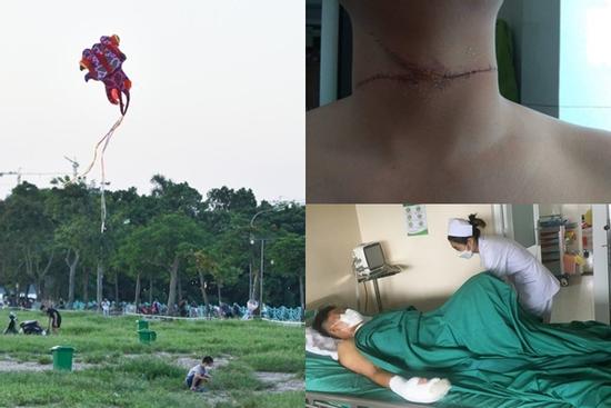 Hà Nội: Dây diều 'sắc như dao' cứa ngang cổ người, chém đứt đầu xe ô tô