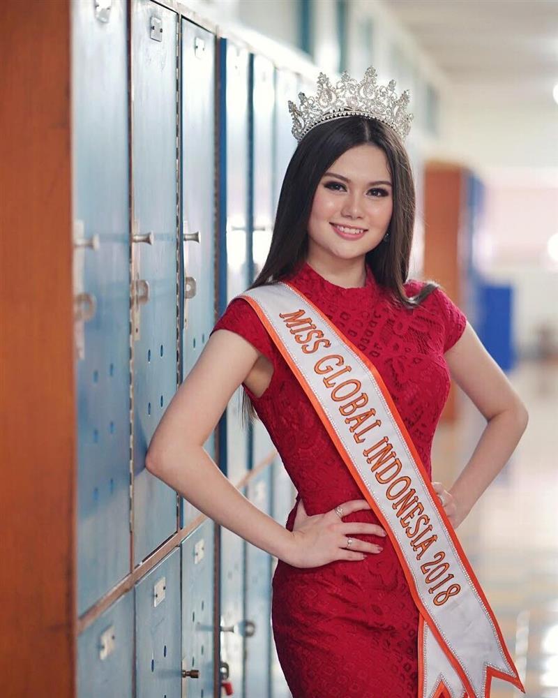 Ngoại hình tân Hoa hậu Hoàn vũ Indonesia gây tranh cãi-5