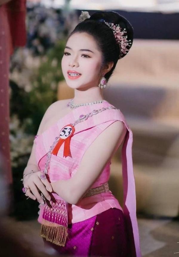 Quá khứ khó khăn của người đẹp cụt 2 chân, 1 tay mới thi hoa hậu-9