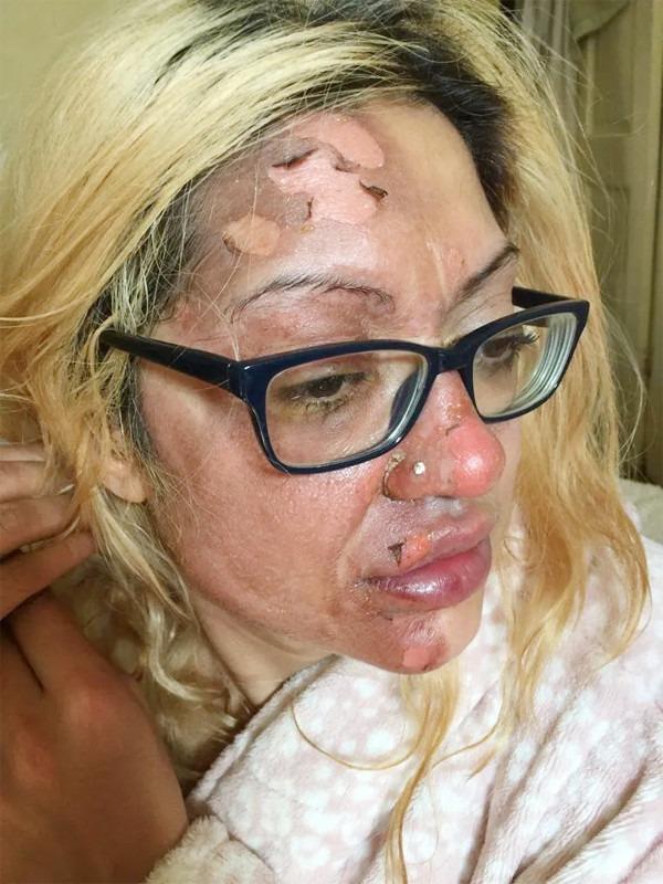 Người phụ nữ bị tàn phá gương mặt sau thử thách cắt trứng luộc-2
