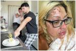 Người phụ nữ bị tàn phá gương mặt sau thử thách cắt trứng luộc