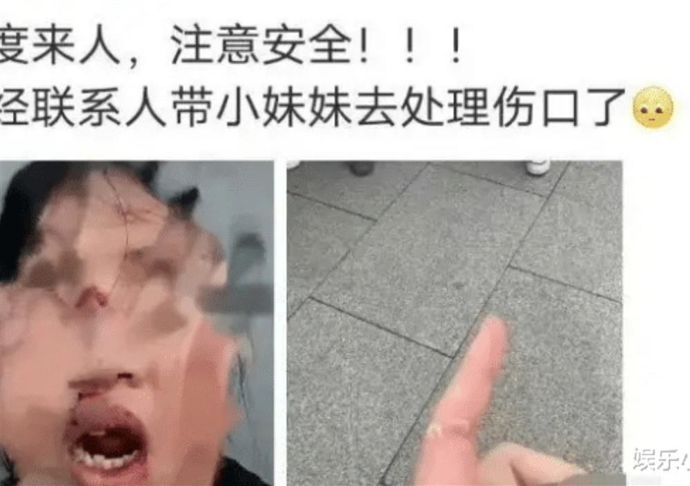 Fan xô xát, concert của TFBoys rơi cảnh hỗn loạn nhiều người ngất-2