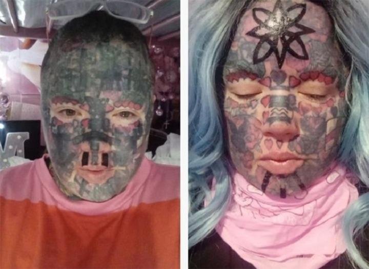 Cô gái bị mù sau khi xăm mắt-3