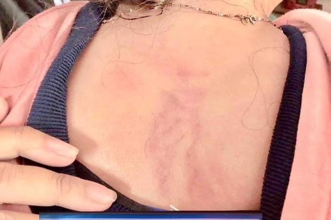 Đau đớn, trầm cảm đi xóa tên người yêu vì chuyện làm giàu-5