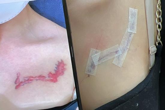 Đau đớn, trầm cảm đi xóa tên người yêu vì chuyện làm giàu