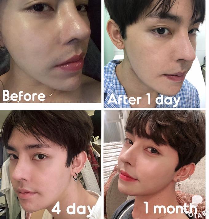 9X Việt chi hàng tỷ đồng, phẫu thuật 11 lần để sở hữu ngoại hình trong mơ-3